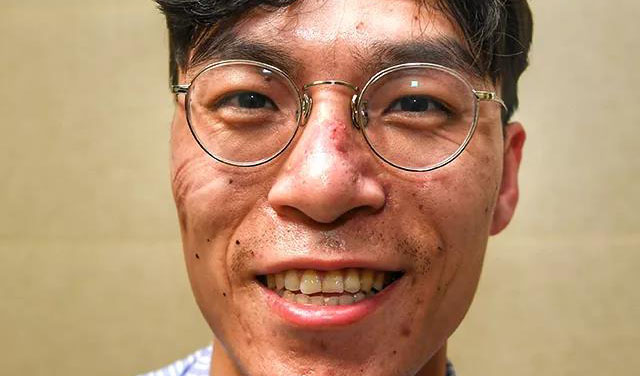 這些刻在我們臉上的印痕，會成為永恒的記憶！