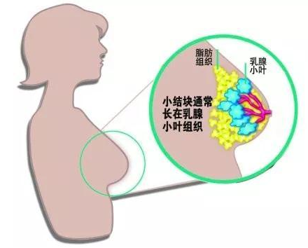 有吸煙習(xí)慣的人患胰腺癌的可能性是不吸煙的人的2至3倍